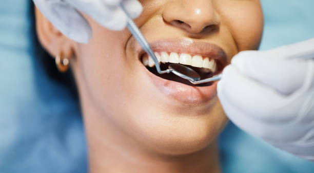 Best Broken or Chipped Tooth Repair in Homestead Meadows South, TX