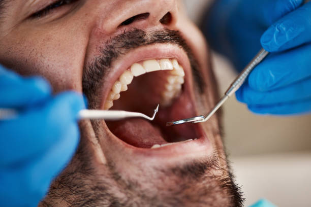 Best Emergency Care for Gum Disease in Homestead Meadows South, TX